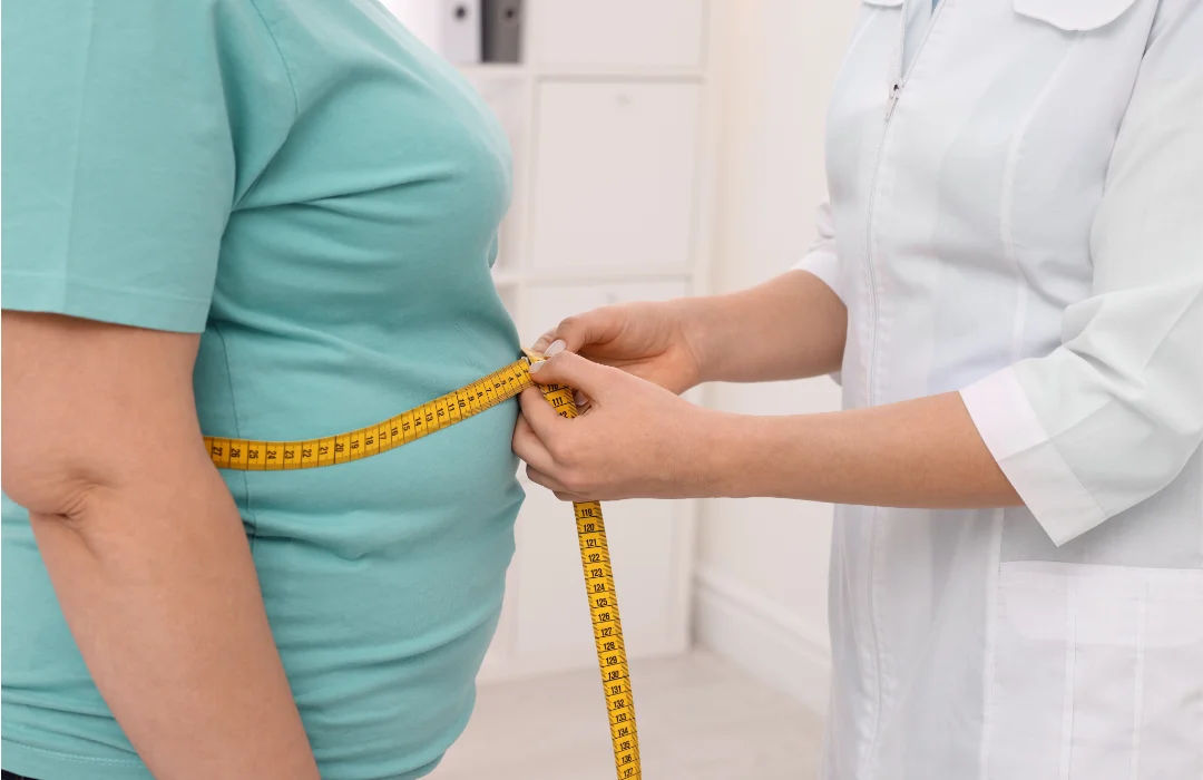 Obesidade cresce três vezes mais em três décadas e atinge um quarto dos brasileiros
