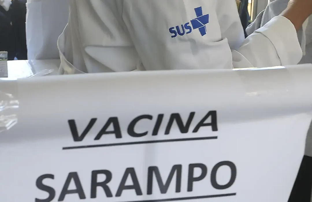 São Paulo registra mais casos de sarampo e chega a 30 notificações no ano